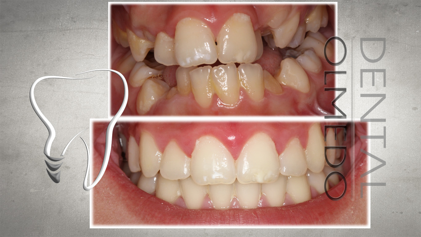 ortodoncia 3