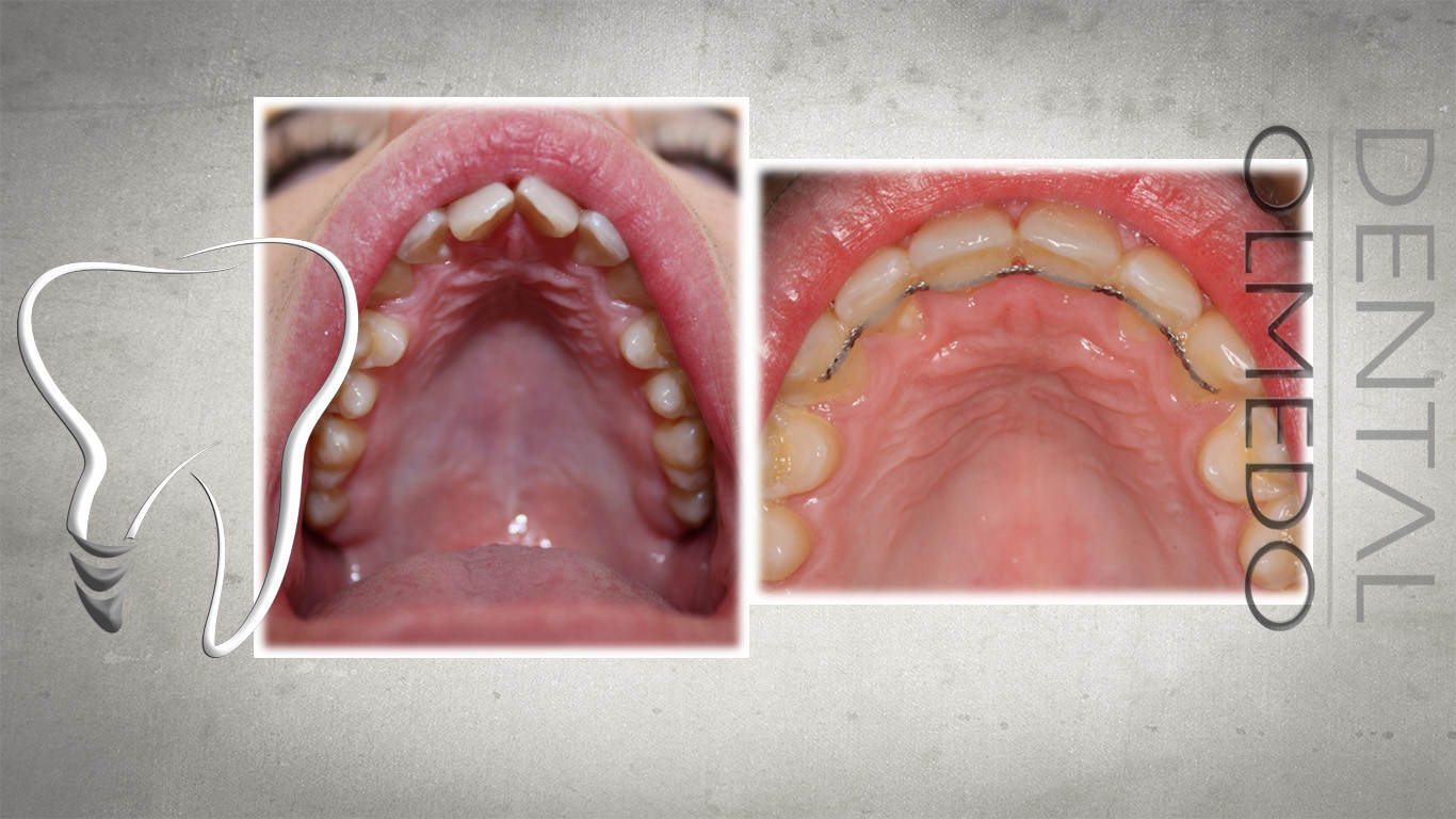 ortodoncia 4